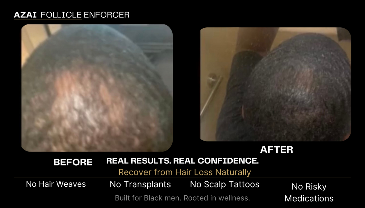 Follicle Enforcer